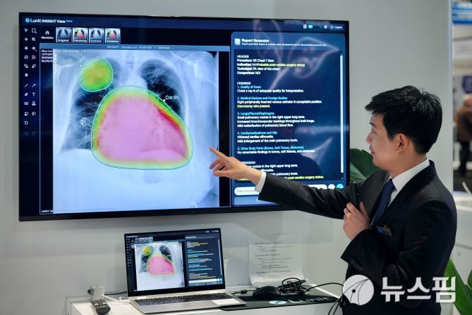 복지부, 국가건강검진 흉부 엑스레이 연령 '65세 이상' 상향 검토