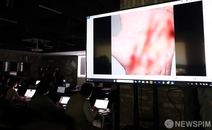 배우 고(故) 김새론 측, 제보자 피습 상처 사진 공개