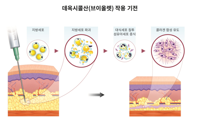 대웅제약 브이올렛 'DCA', 팔뚝 피하지방 분해효과 입증