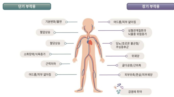 중증 천식 환자 전신 스테로이드 반복, 부작용 유발…질병청, 사용기준 체계화